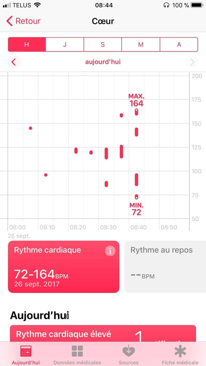 Mon Apple Watch a détecté une crise d’arythmie cardiaque avant moi